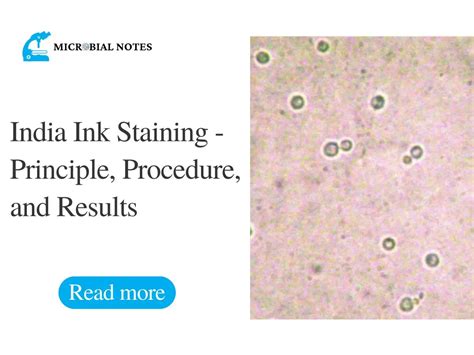 What does India ink stain do